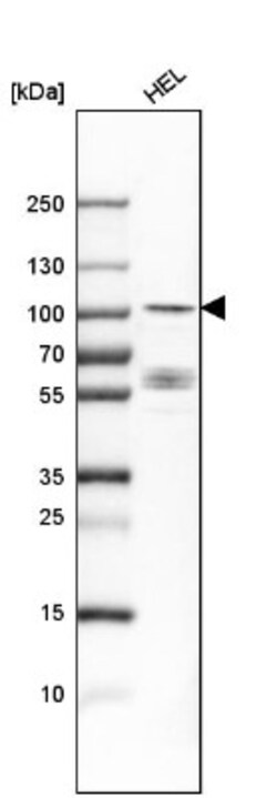 DYRK1A Antibody, Novus Biologicals 25 &mu;L; Unlabeled:Antibodies, Polyclonal